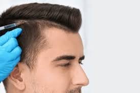 Regain Confidence with Hair Transplant in Dubai: Your Ultimate Guide